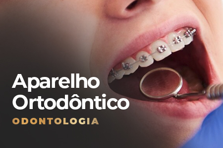 aparelho ortodôntico na Sena Select
