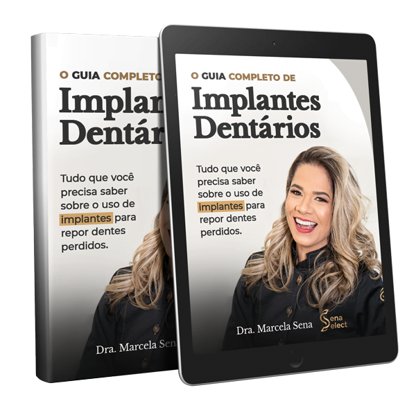 Ebook Guia Completo de Implantes Dentários