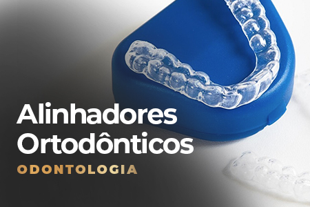 alinhadores ortodônticos na Sena Select