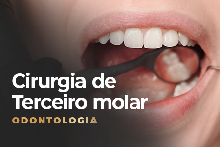 extração de terceiro molar
