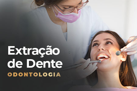 Extração de Dente na Sena Select
