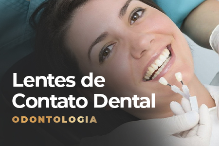 lentes de contato dentais na sena select
