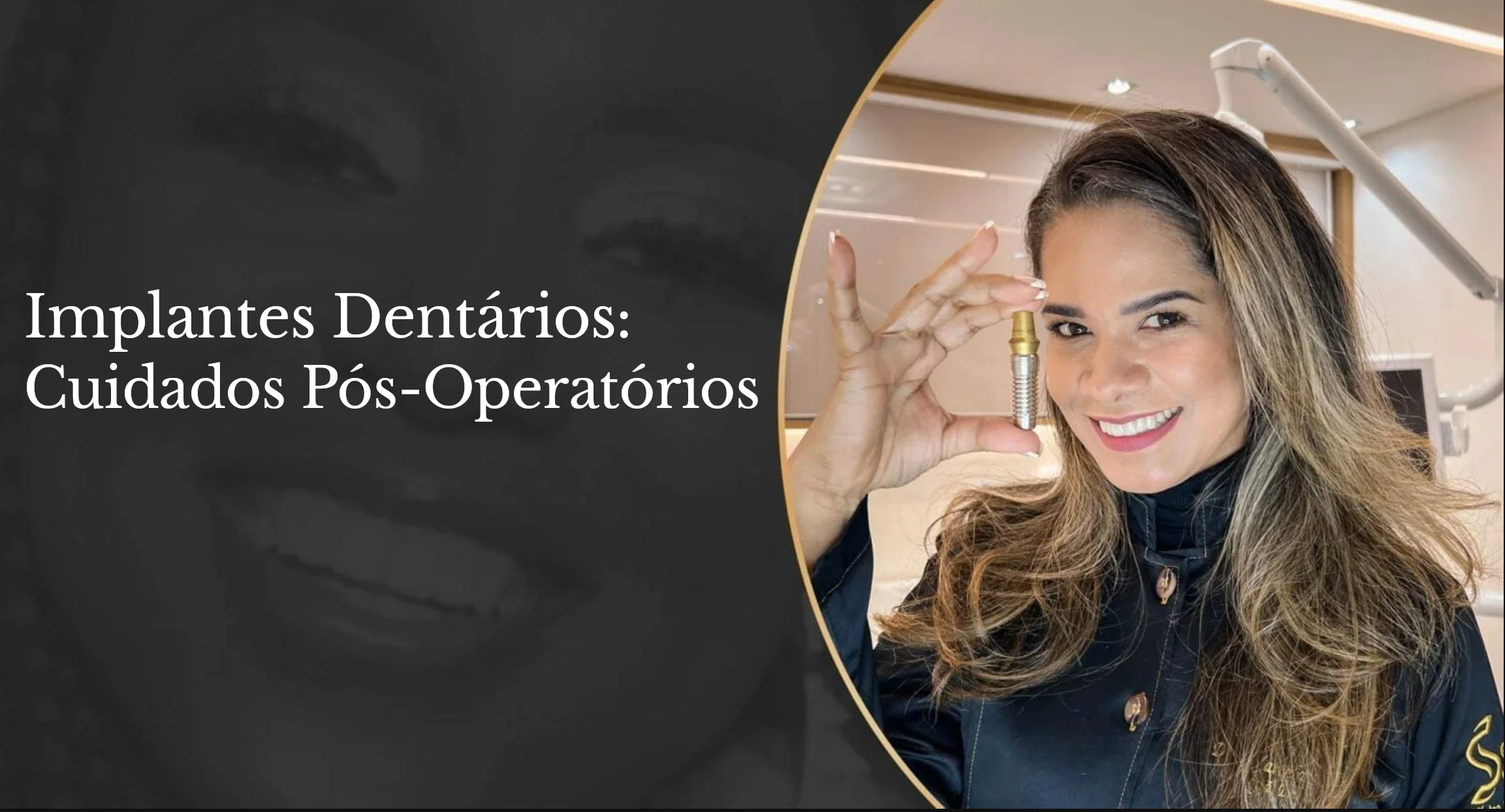 implante-dentario-cuidados-pós-operatórios