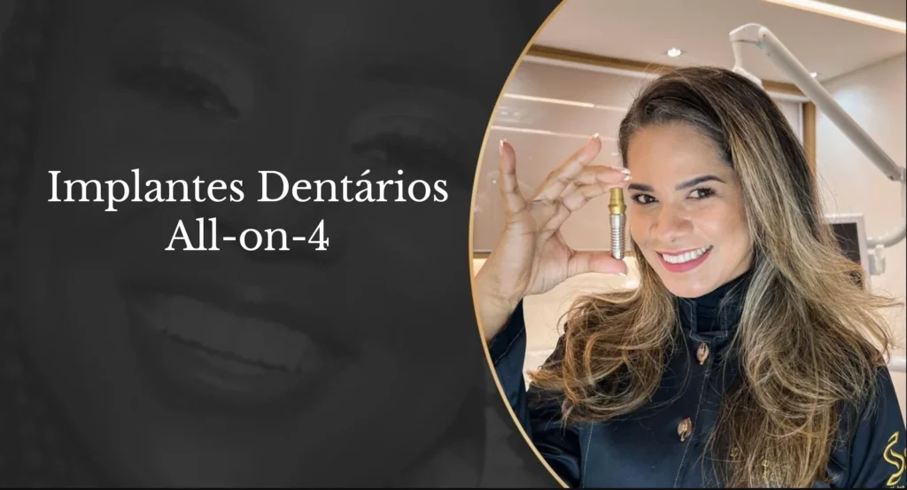 Implantes dentários all-on-4