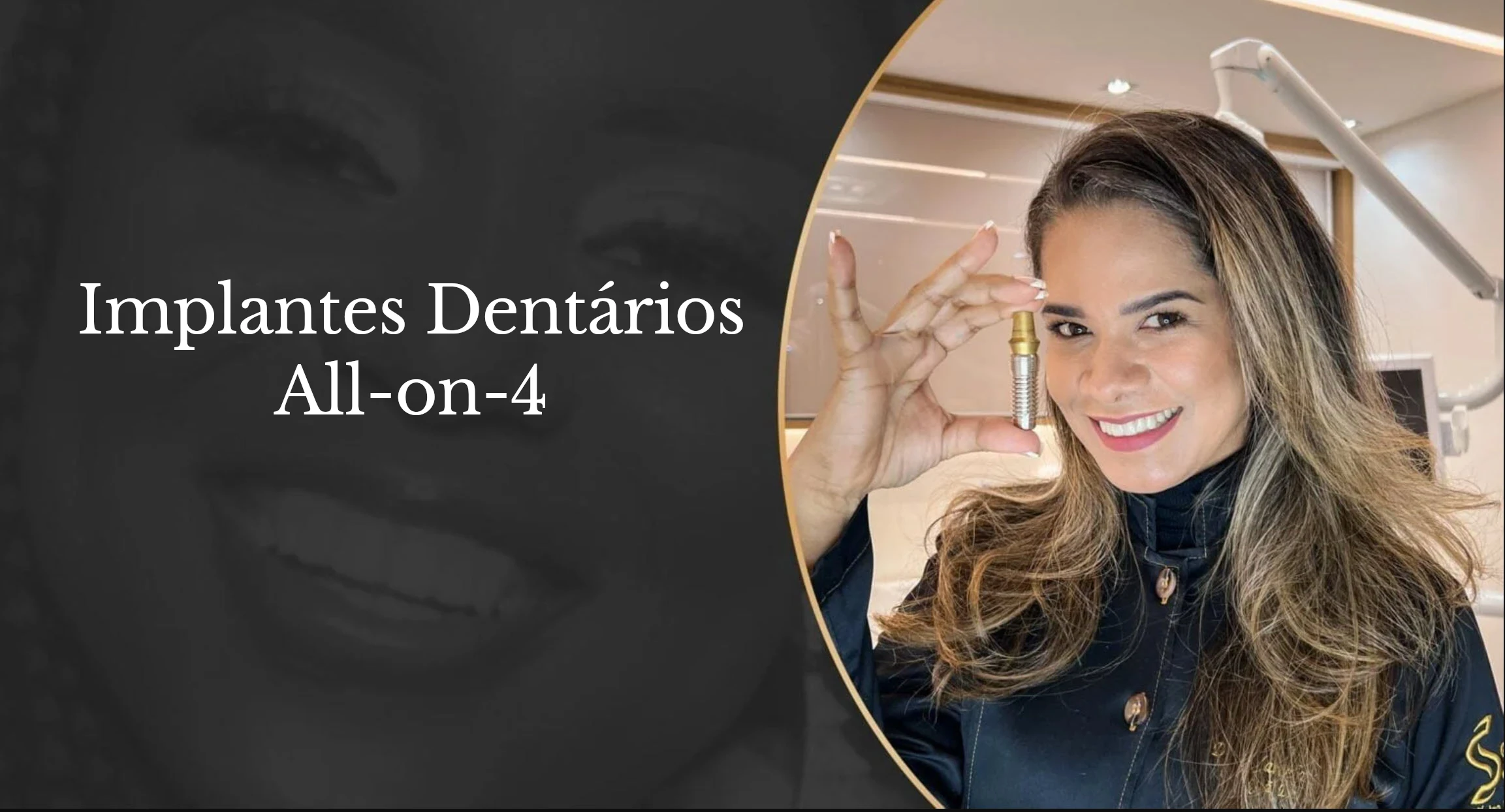 Implantes dentários all-on-4