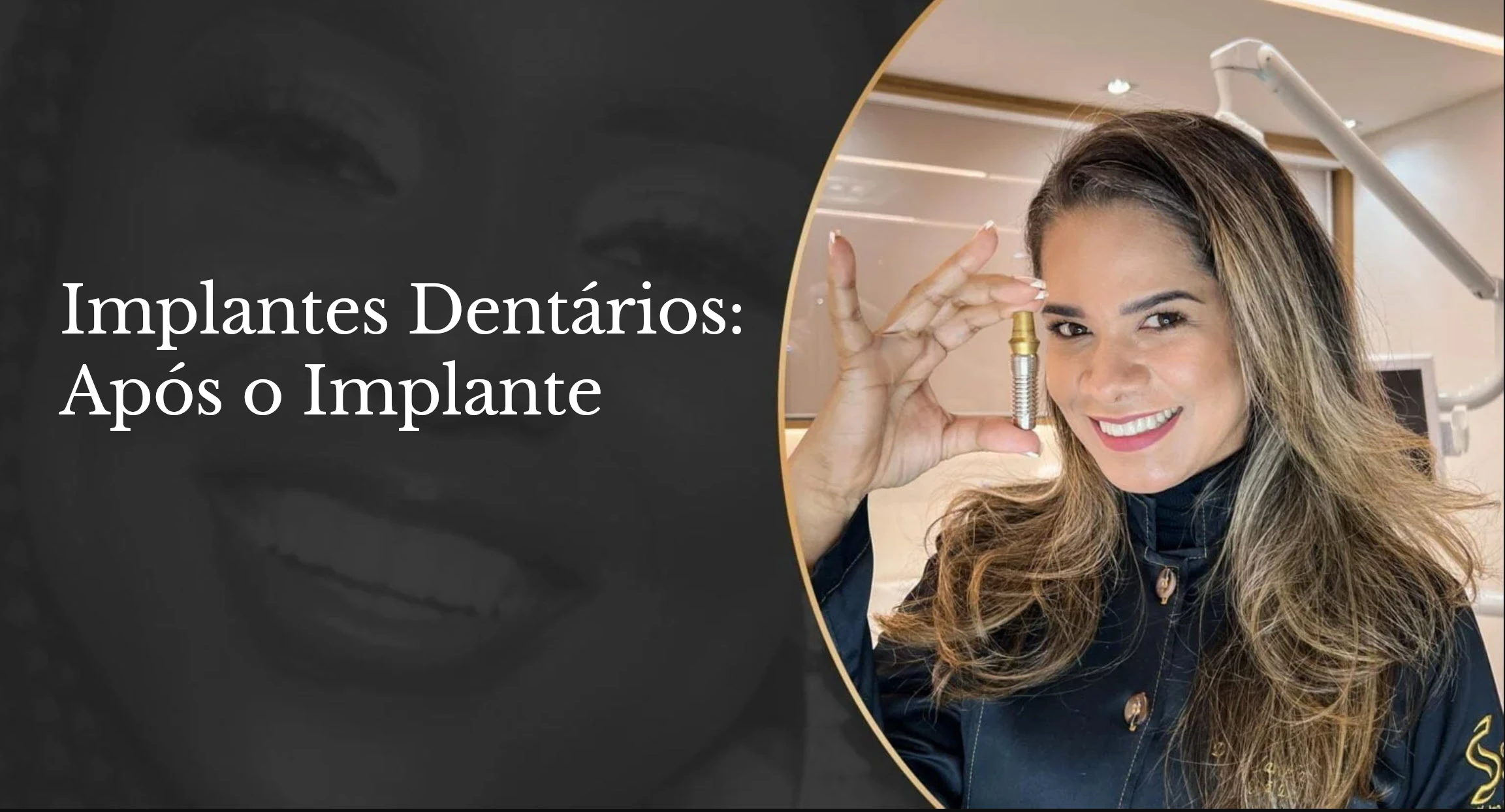 Cuidados após o implante dentário