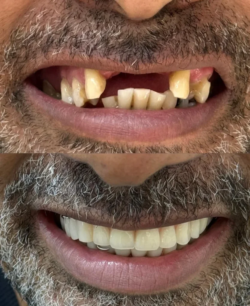 Marcelo Paulo foto depoimento antes e depois clínica Sena Select